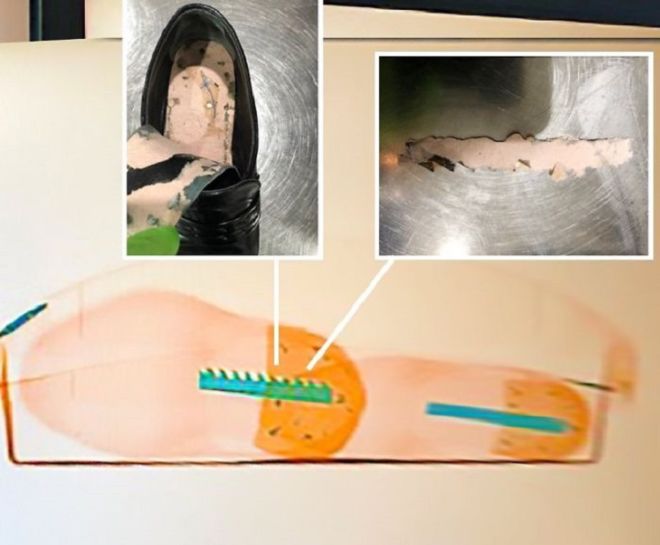 18 Shocking Things Confiscated By The Airport Authorities